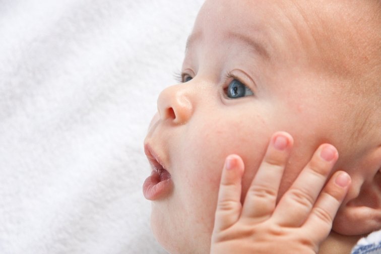 alergijski osip kod beba